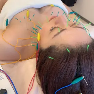 新宿hari-me所属・美容鍼hari-me 新宿のエステ・リラクイメージ