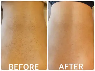 ハーブピーリング 🌿京橋のエステ・リラクイメージ