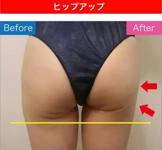 Luca所属・Luca ﾙｶのエステ・リラクイメージ