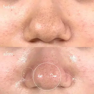 アイブロウ アイブロウサロンTreat myself所属・Treat myselfの眉毛・アイブロウイメージ