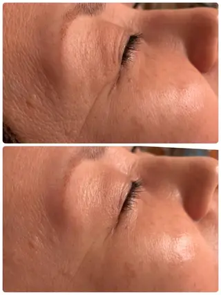 aimee　肌質改善サロン【アイミー】所属・肌質改善サロン aimee｜アイミーのエステ・リラクイメージ