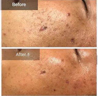 ALIA Scintiller  アリアサンティエ所属・齋藤 祐里耶のエステ・リラクイメージ