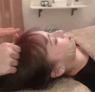 TIARABO 小顔美容鍼のエステ・リラクイメージ