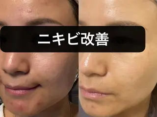 林 エステサロン（自宅）のエステ・リラクイメージ