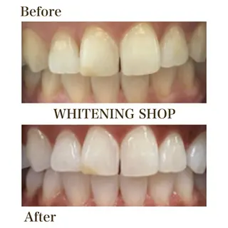 ホワイトニングショップ静岡葵区店所属・ホワイトニング ショップ静岡葵区店のその他イメージ