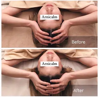 ハーブピーリング 肌再生ピーリング/のエステ・リラクイメージ