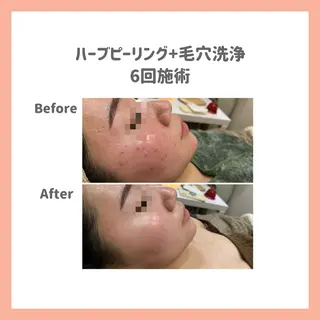 脱毛&フェイシャル 専門店muro.のエステ・リラクイメージ