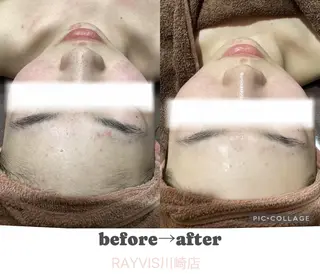 🌷U24毛穴エステ レイビス川崎🌷のエステ・リラクイメージ