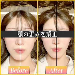 歪み専門💫筋膜整体 てんてん　畠山のエステ・リラクイメージ