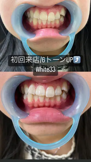 メンズ セルフホワイトニング White33大名のその他イメージ