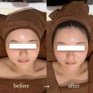 NOEL所属・フェイシャルエステ Utaiのエステ・リラクイメージ