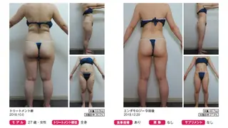 オレンジバナナ 亀貝インター店のエステ・リラクイメージ