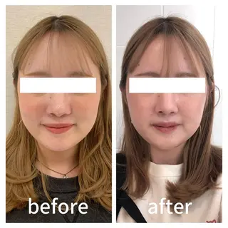 小顔サロン AMYONのエステ・リラクイメージ