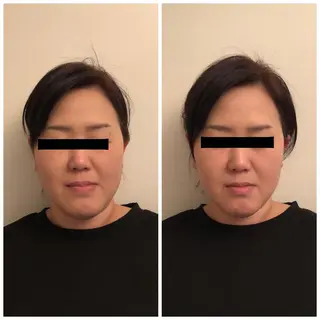 おうちサロン B-ROOMのエステ・リラクイメージ