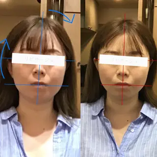 顔の歪み矯正専門 宮内翔のエステ・リラクイメージ