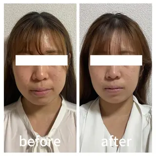 小顔サロン AMYONのエステ・リラクイメージ