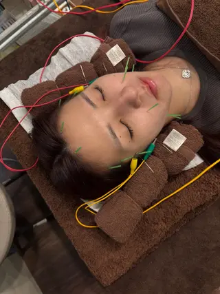 小林整骨院本町 美容鍼roomのエステ・リラクイメージ