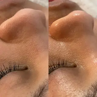 宮崎 みおのエステ・リラクイメージ