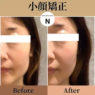 恵比寿/小顔/矯正 美容整体師⭐︎Aiのエステ・リラクイメージ
