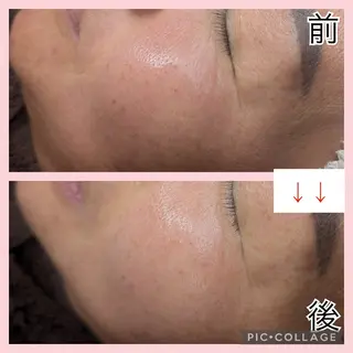 肌質改善プライベートサロンwith U所属・肌質改善サロン with Uのエステ・リラクイメージ