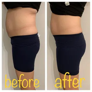 リンパマッサージ&ピラティスmimoza所属・リンパマッサージ mimozaのエステ・リラクイメージ