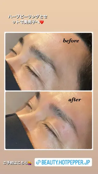 アイブロウ ハーブピーリング/韓国肌管理/フェイシャル/毛穴洗浄/眉毛/顔脱毛【糸脱毛専門】rev所属・ハーブピーリング🌹 毛穴洗浄❤️眉waxのエステ・リラクイメージ