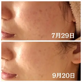 フェイシャル専門サロ ン ERINのエステ・リラクイメージ