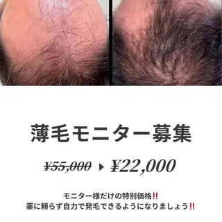 メンズ キッズ 美肌脱毛エステサロン Luangeのエステ・リラクイメージ