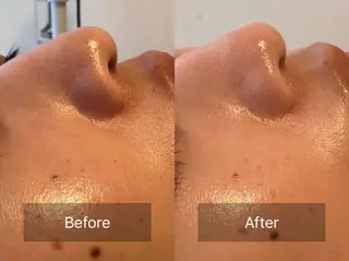 天使の艶肌　REVIハーブピーリング＆ヘッドスパ 武蔵小杉店所属・天使の 艶肌のエステ・リラクイメージ