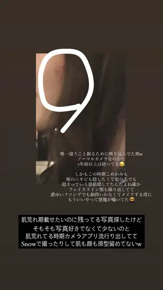 肌質改善 KALANCHOEのエステ・リラクイメージ