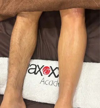 メンズ 肌質改善◇結果重視 美麗-MIREI-のマツエク・マツパデザイン