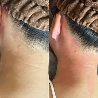 六本木脱毛andS さおりのエステ・リラクイメージ