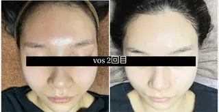 代表 MOMOのエステ・リラクイメージ