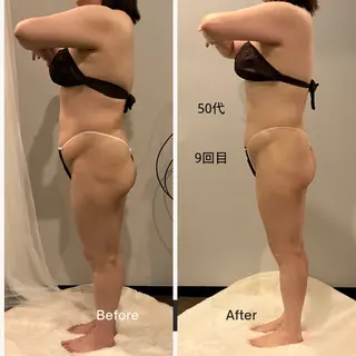 ✨痩身 ✨ハイパーナイフEXのエステ・リラクイメージ