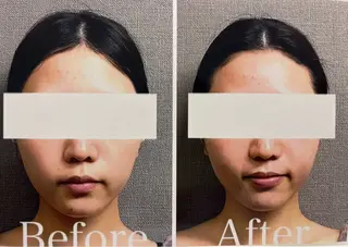 MIRAI小顔 溝の口店のエステ・リラクイメージ