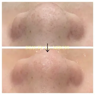 ビューティー ミロワールのエステ・リラクイメージ