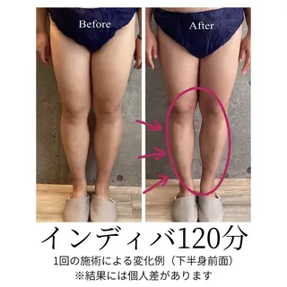 さくらんぼ鍼灸院所属・美容鍼&温活・免活 さくらんぼ鍼灸院のエステ・リラクイメージ