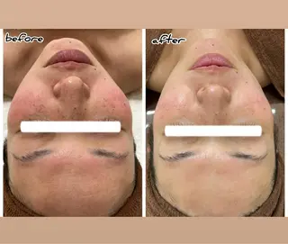 A/S アズのエステ・リラクイメージ