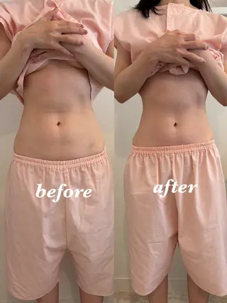 腸活サポート みなみののエステ・リラクイメージ