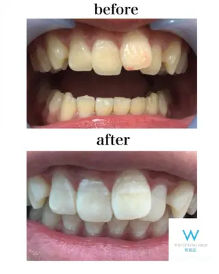 メンズ キッズ ホワイトニングショップ町田店所属・ホワイトニング ショップ町田店のその他イメージ