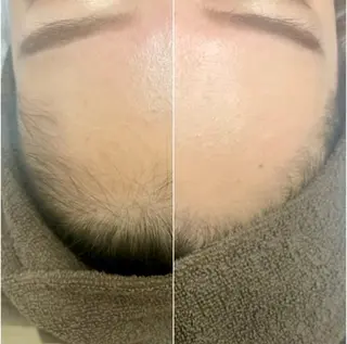 脱毛サロンLULA 恵比寿店　笠松のエステ・リラクイメージ