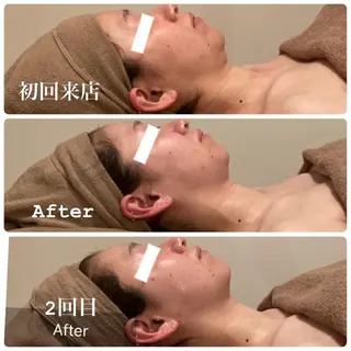 Ｂ&H所属・頭痛•肩こり専門/ 眉サロンB&H心斎橋のエステ・リラクイメージ