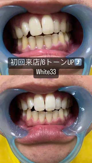 メンズ セルフホワイトニング White33大名のその他イメージ