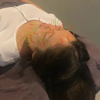 美容鍼灸整体サロンBeAu所属・美容鍼灸師 川口 愛華のエステ・リラクイメージ