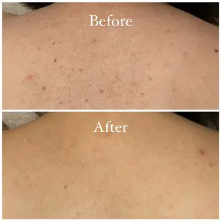 坂下 千歩のエステ・リラクイメージ