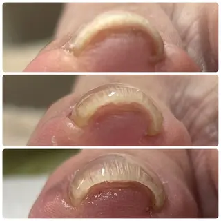 ネイル なが さきのネイルデザイン