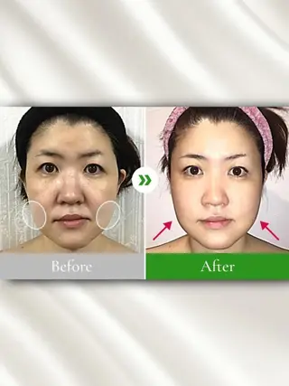 小顔整体研究所 KSラボ川崎店内田のエステ・リラクイメージ