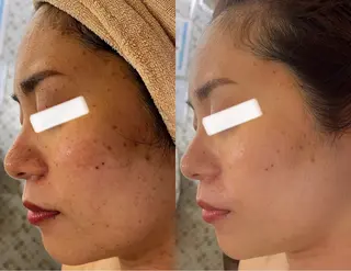 小顔&美肌品川店 Masqueradeのエステ・リラクイメージ