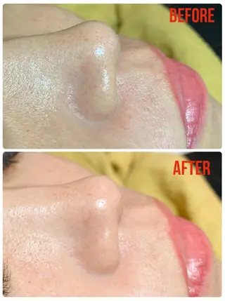 Reir所属・Reir・ SHIORIのマツエク・マツパデザイン