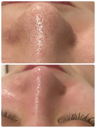 Dione八王子店所属・LUKE （ルーク）のエステ・リラクイメージ